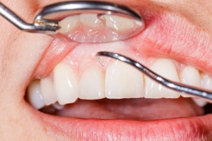 Причины болезни зубов и десен